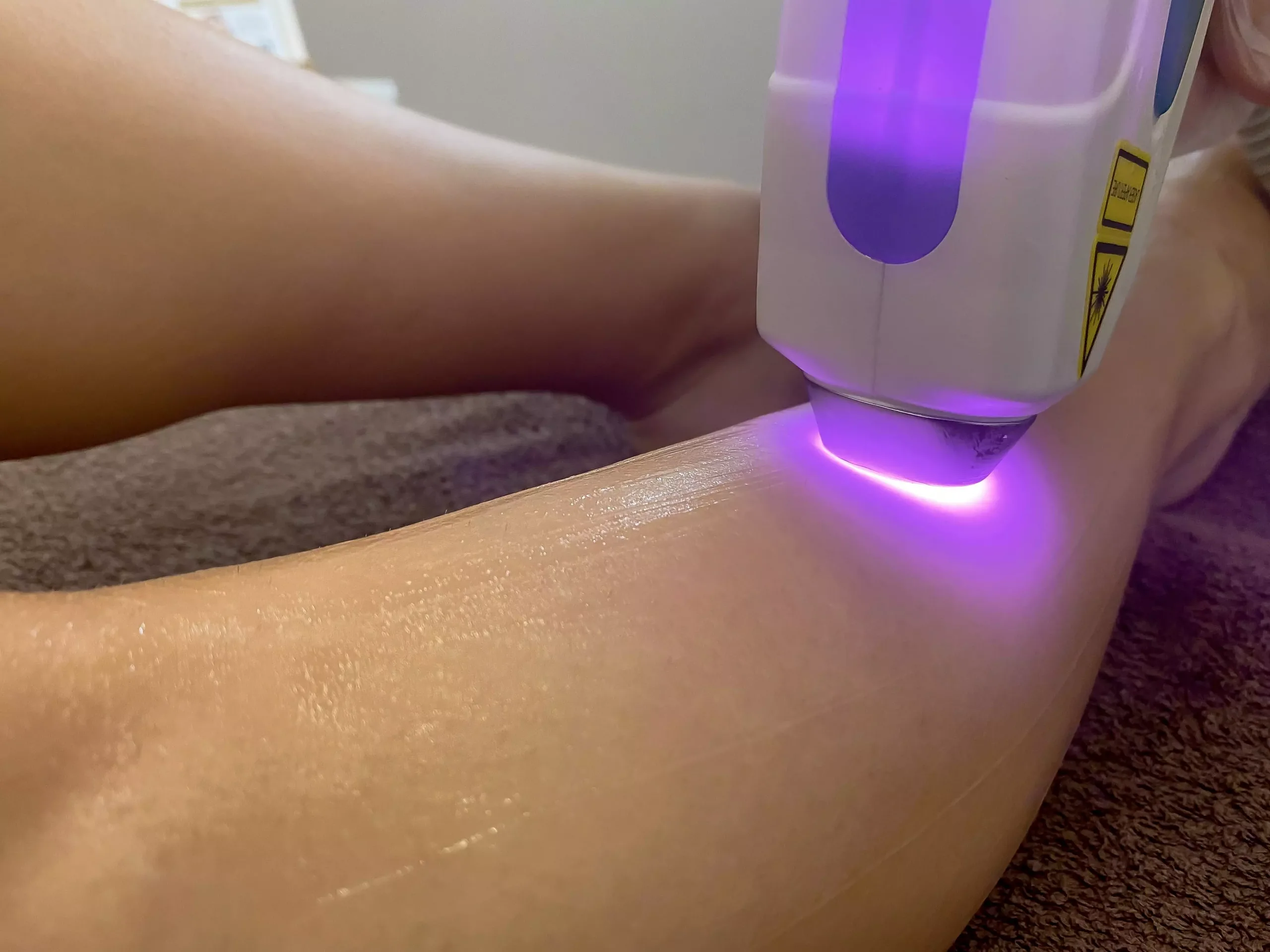 Epilazione Laser - Hintime Beauty & Spa Treviglio